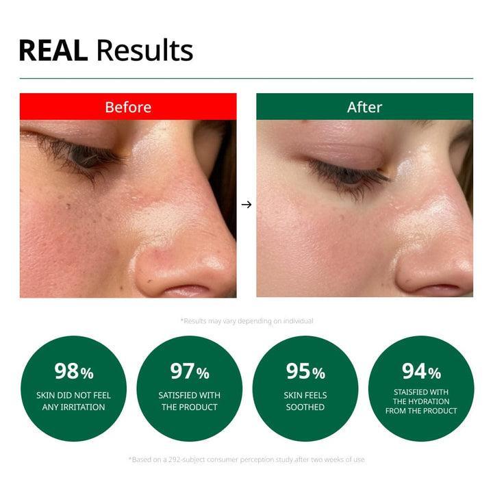 Dr.G - Red Blemish Clear Soothing Cream 70ml
