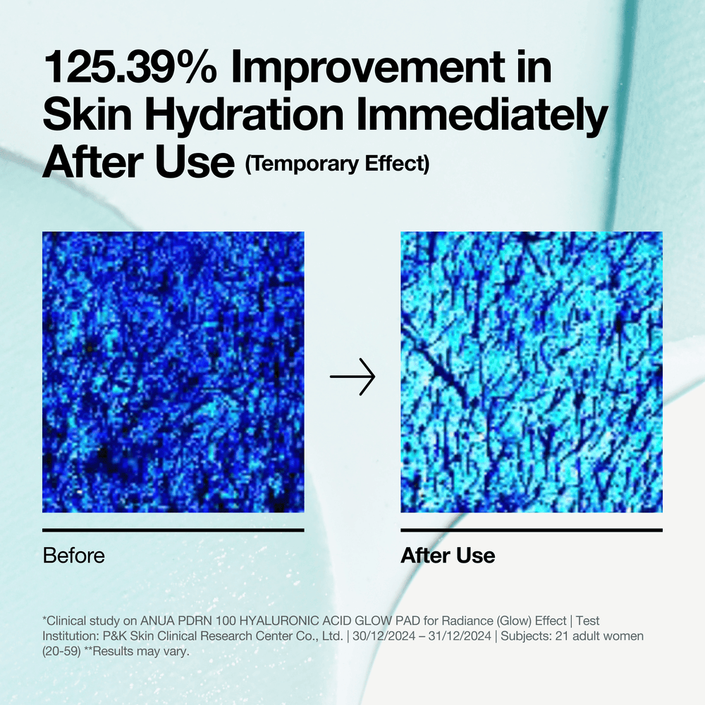 Anua - PDRN 100 Hyaluronic Acid Glow Pad 180ml 60ea