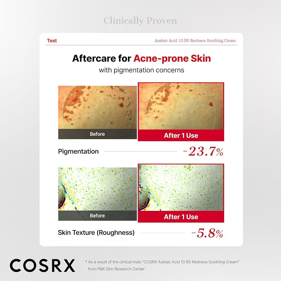 COSRX - Azelaic Acid 10 B5 Redness Soothing Cream Gel 30ml