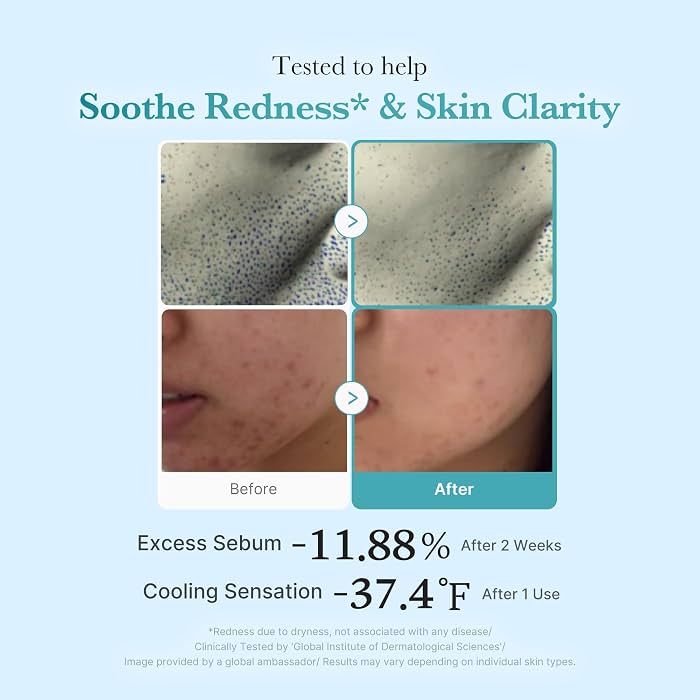 medicube - Azelaic Acid Niacinamide Clarifying Toner 250ml