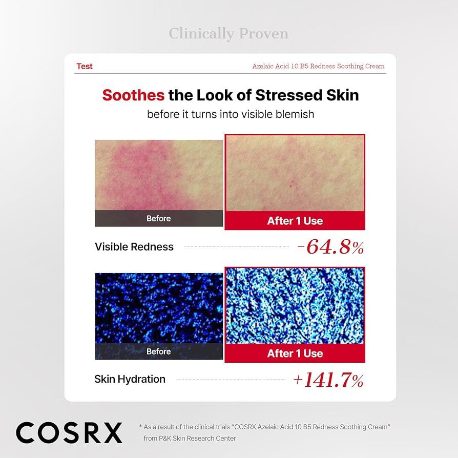 COSRX - Azelaic Acid 10 B5 Redness Soothing Cream Gel 30ml